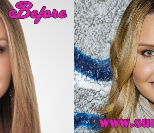 Amanda Bynes Plastic Surgery