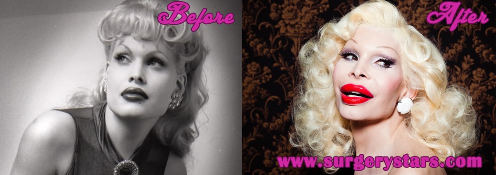 Amanda Lepore Plastic Surgery