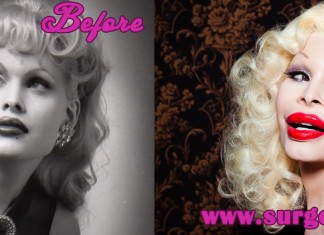 Amanda Lepore Plastic Surgery