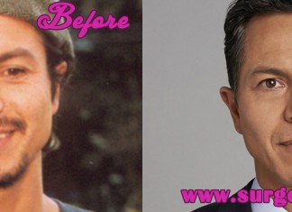 Benjamin Bratt Nose Job