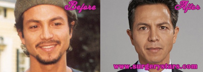 Benjamin Bratt Nose Job