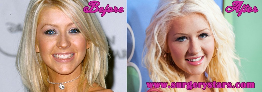 Christina Aguilera Plastic Surgery 