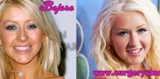 Christina Aguilera Plastic Surgery