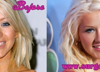 Christina Aguilera Plastic Surgery