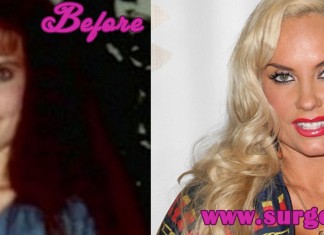 Coco Austin Plastic Surgery