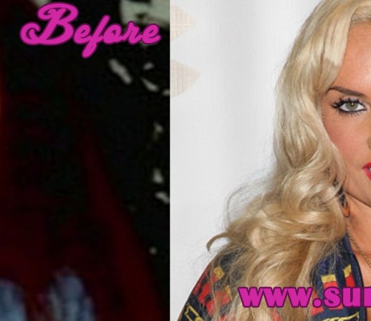 Coco Austin Plastic Surgery