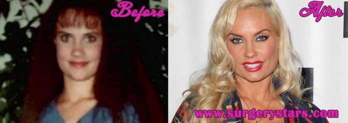 Coco Austin Plastic Surgery