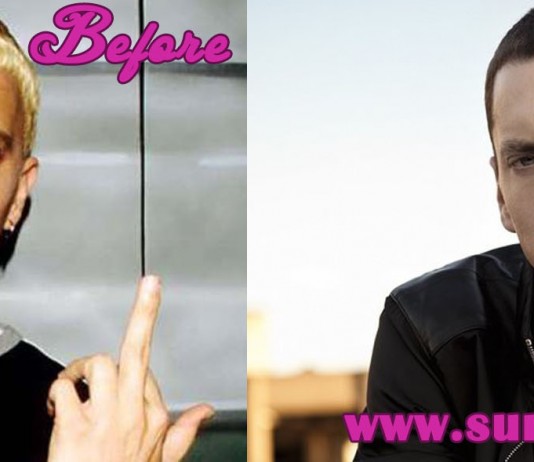 Eminem Plastic Surgery