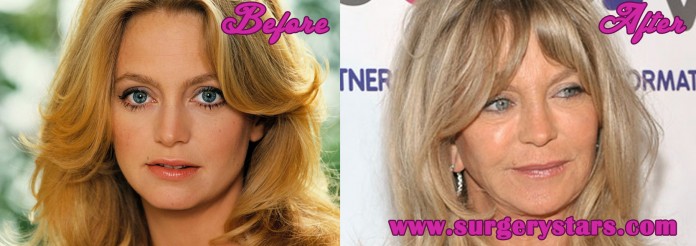 Goldie Hawn Plastic Surgery