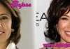 Jeanine Pirro Plastic Surgery