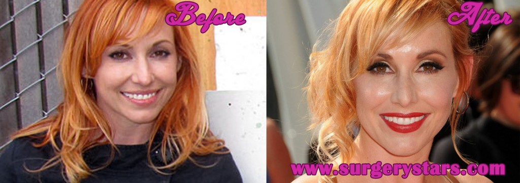 Kari Byron Plastic Surgery