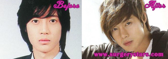 Kim Hyun Joong Plastic Surgery