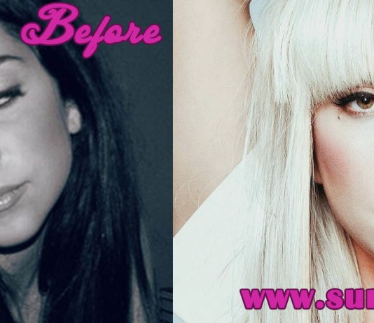 Lady Gaga Plastic Surgery
