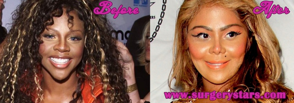 Lil Kim Plastic Surgery