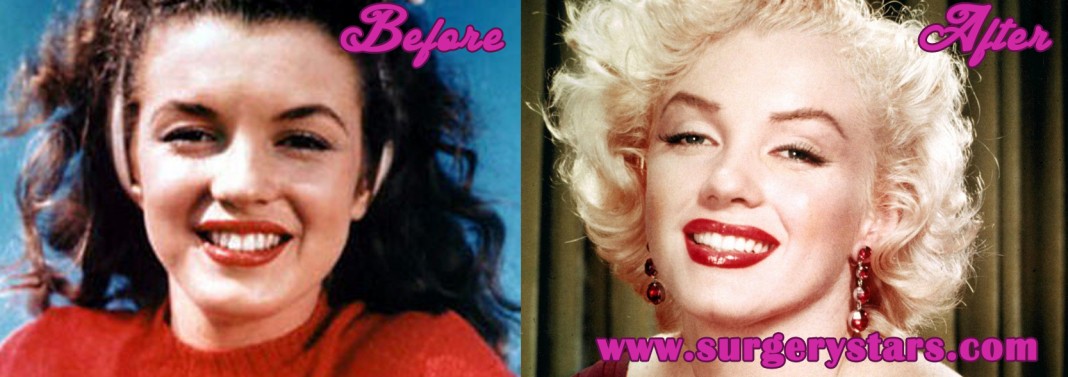 Marilyn Monroe Plastic Surgery Before And After Pic