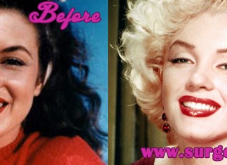 Marilyn Monroe Plastic Surgery