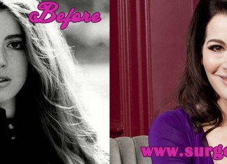 Nigella Lawson Plastic Surgery