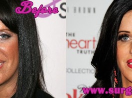 Patti Stanger Plastic Surgery