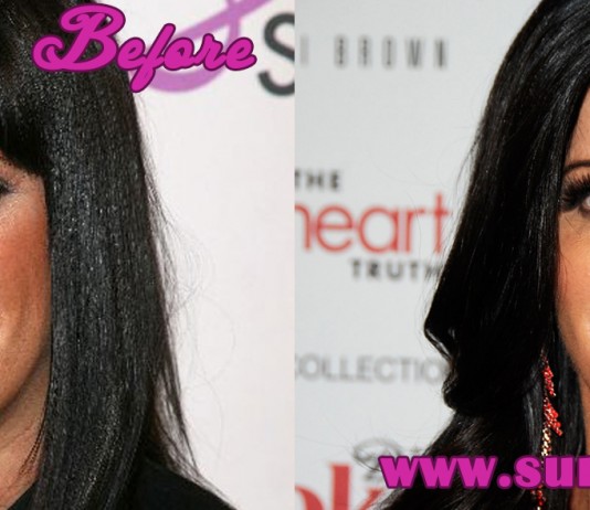Patti Stanger Plastic Surgery