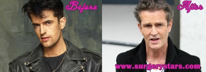 Rupert Everett Plastic Surgery