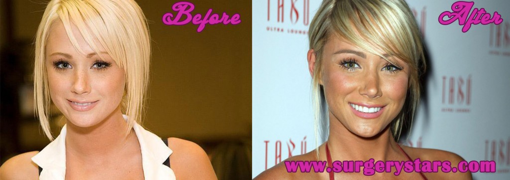 Sara Jean Underwood Plastic Surgery