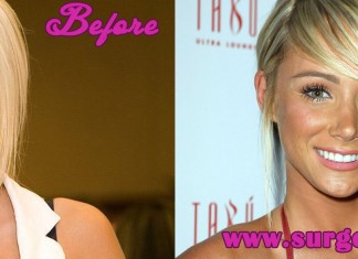 Sara Jean Underwood Plastic Surgery