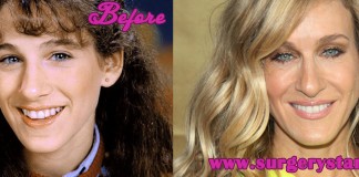 Sarah Jessica Parker Plastic Surgery