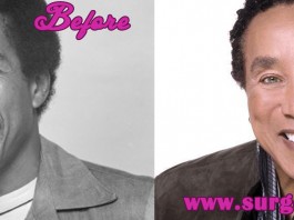 Smokey Robinson Plastic Surgery