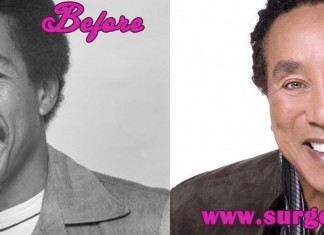 Smokey Robinson Plastic Surgery