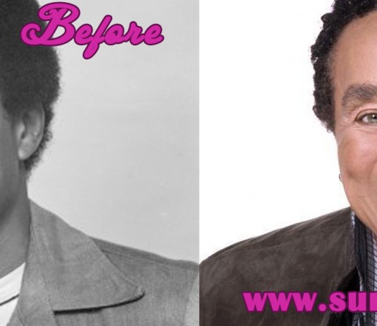 Smokey Robinson Plastic Surgery