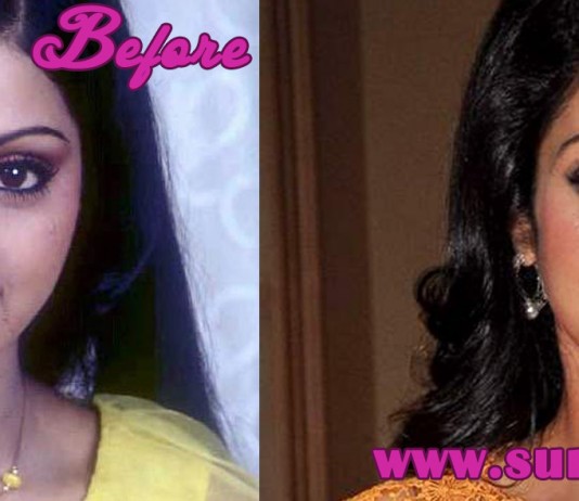 Sridevi Plastic Surgery