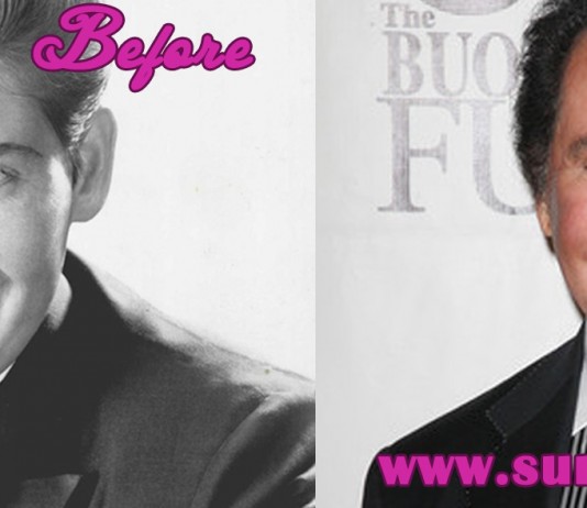 Wayne Newton Plastic Surgery