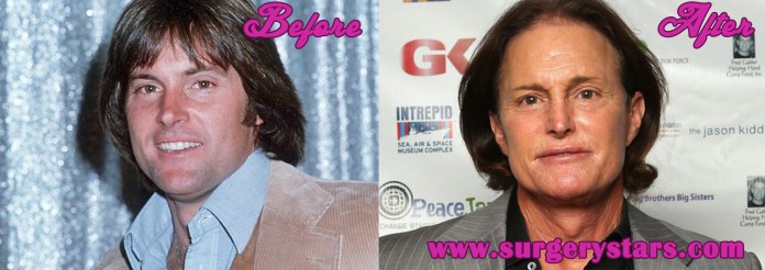 Worst Plastic Surgery Bruce Jenner