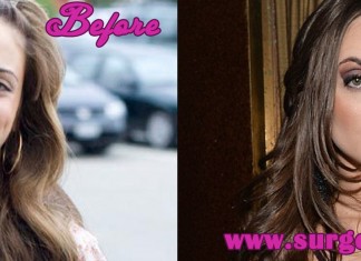 Alexa Ray Joel Nose Job