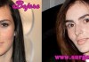 Ali Lohan Plastic Surgery