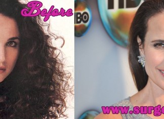 Andie MacDowell Plastic Surgery