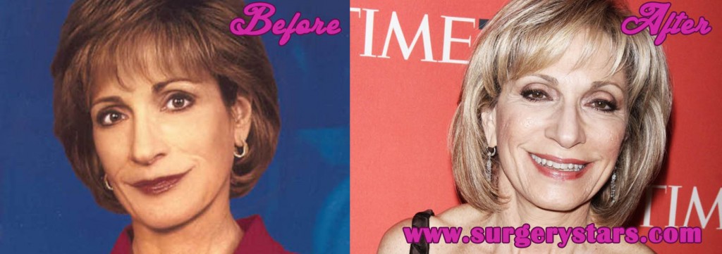 Andrea Mitchell Age