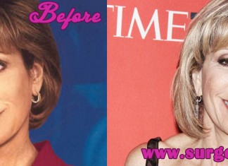 Andrea Mitchell Age