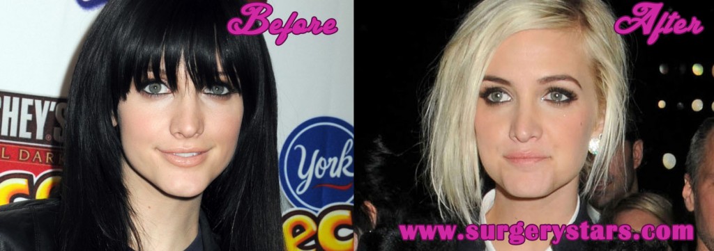 Ashlee Simpson Nose Job