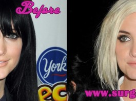 Ashlee Simpson Nose Job