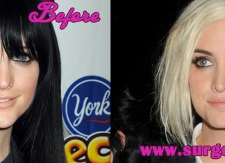Ashlee Simpson Nose Job