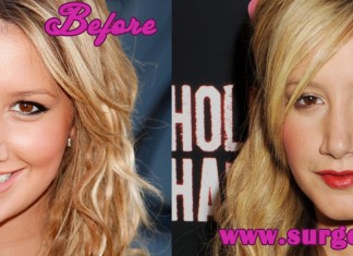 Ashley Tisdale Nose Job