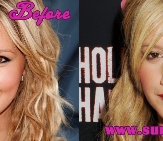 Ashley Tisdale Nose Job