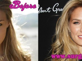 Bar Refaeli Plastic Surgery