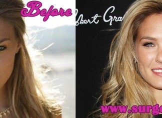Bar Refaeli Plastic Surgery