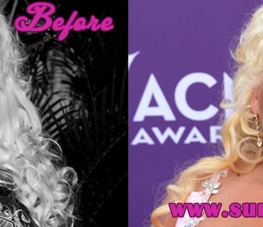 Beth Chapman Plastic Surgery