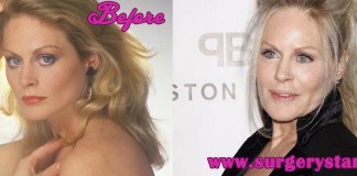 Beverly d Angelo Plastic Surgery