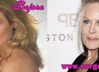 Beverly d Angelo Plastic Surgery
