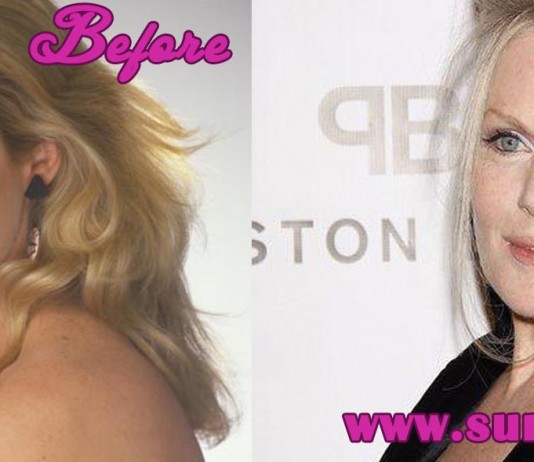 Beverly d Angelo Plastic Surgery
