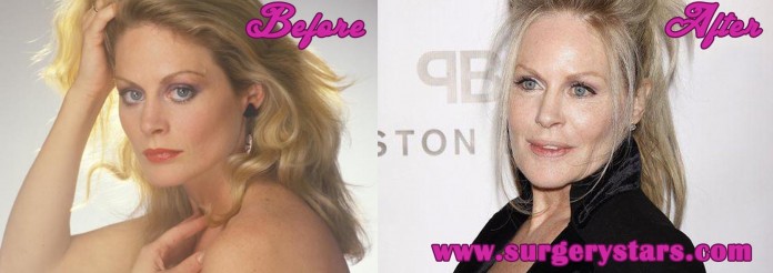 Beverly d Angelo Plastic Surgery